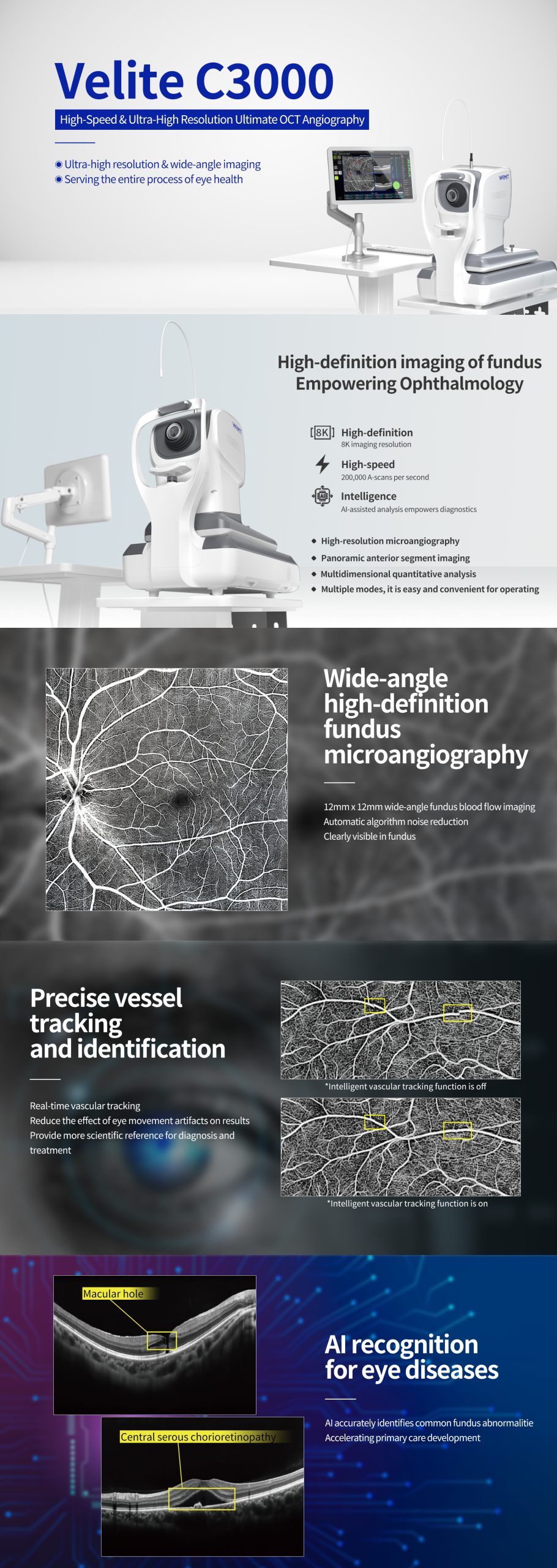 WRMT VELITE C3000 - High-Speed & Ultra-High Resolution AI OCT Angiography - Image 5