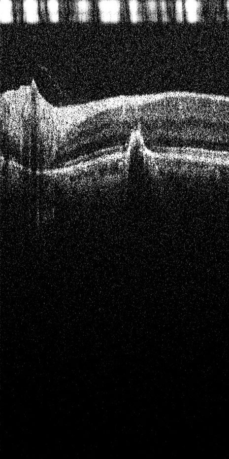 MEDEVPLUS IXANNER 7VN - PORTABLE OCT - Image 13
