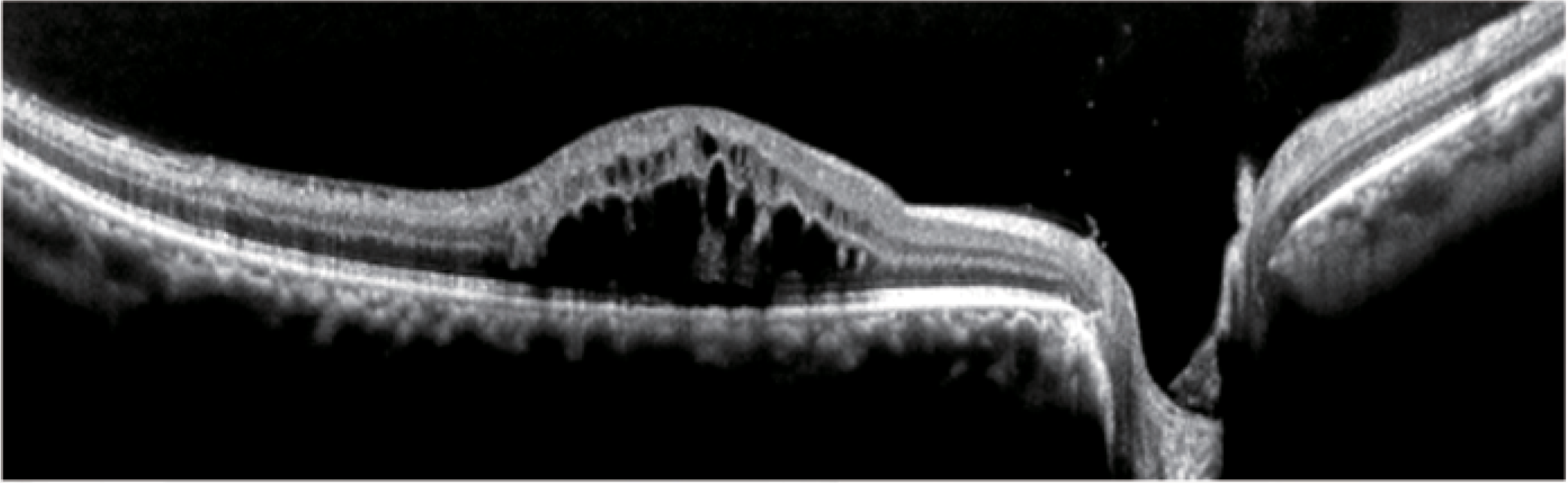 WRMT VELITE C1000 - Artificial Intelligence OCT/A - Image 16