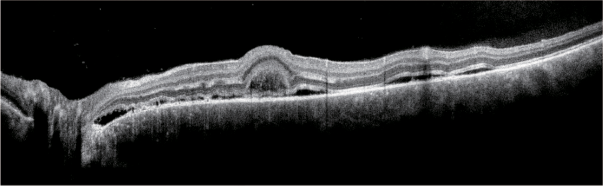 WRMT VELITE C1000 - Artificial Intelligence OCT/A - Image 17