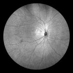 Infrared(NIR)