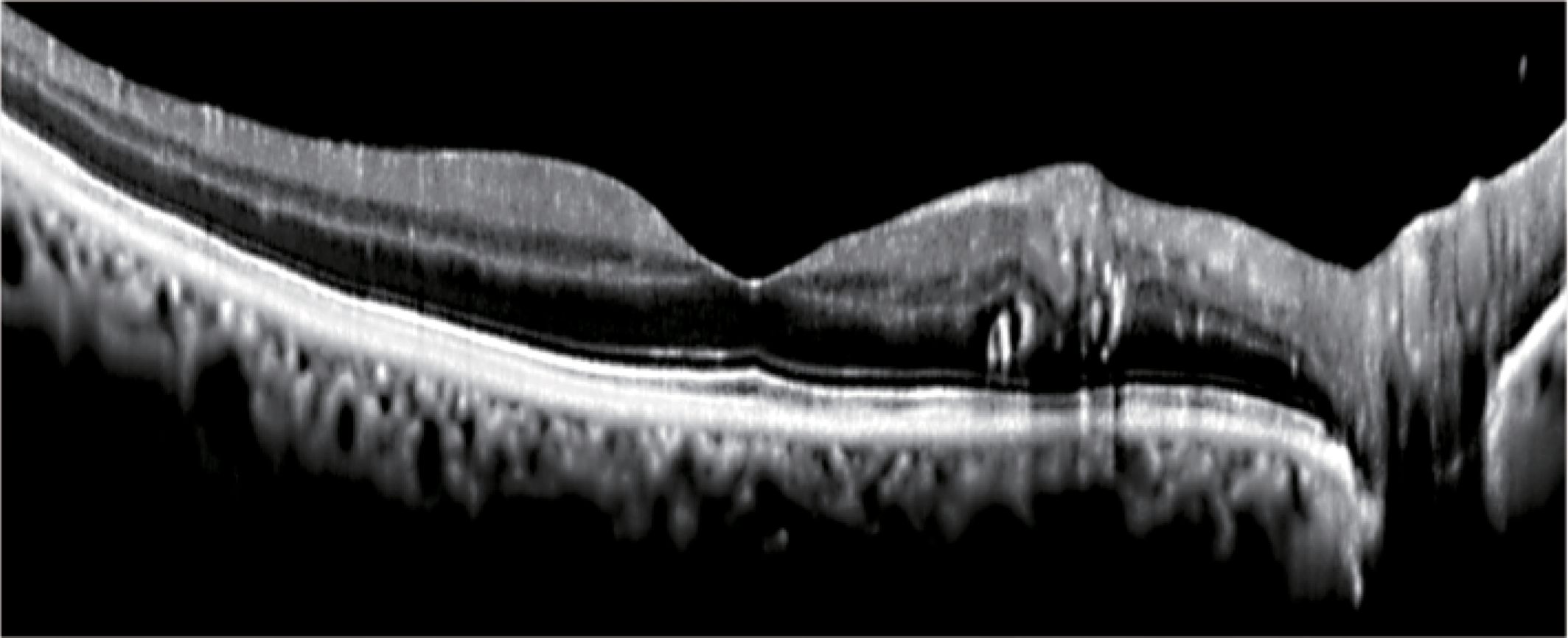 WRMT VELITE C1000 - Artificial Intelligence OCT/A - Image 13