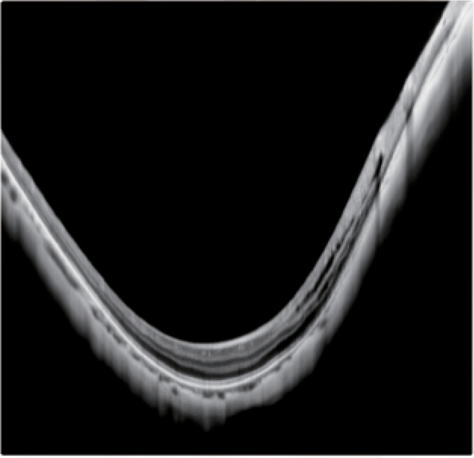 WRMT VELITE C1000 - Artificial Intelligence OCT/A - Image 15