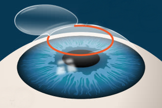 EYEΦΟS Φ FEMTO VISUM 1MHz - Image 10